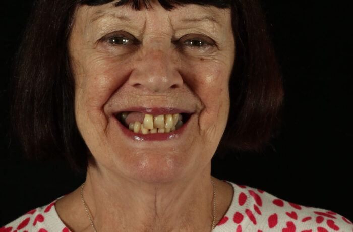 Before - Cheadle Hulme Dental