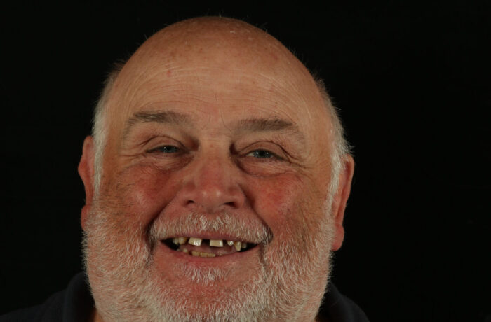 Before - Cheadle Hulme Dental