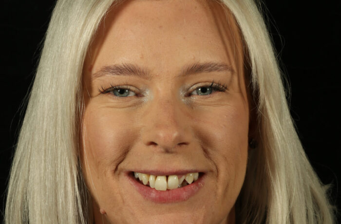Before - Cheadle Hulme Dental