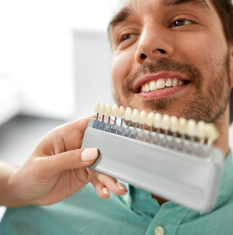 Teeth Whitening