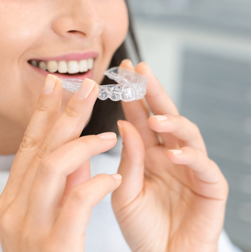 blog - Cheadle Hulme Dental
