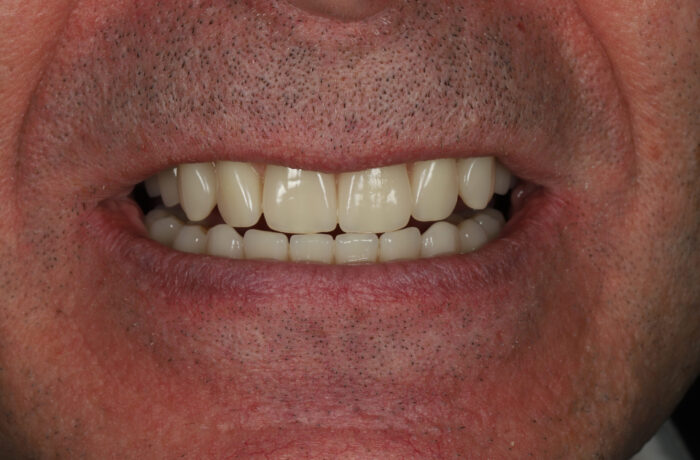 After - Cheadle Hulme Dental