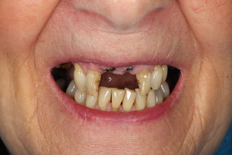 Before - Cheadle Hulme Dental