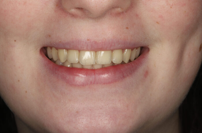 After - Cheadle Hulme Dental