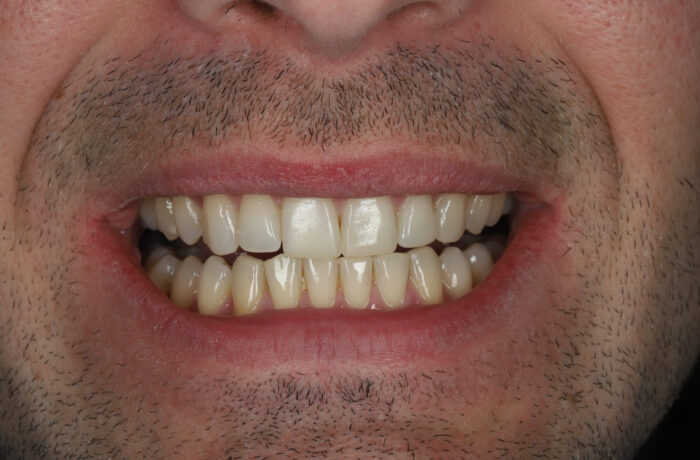 After - Cheadle Hulme Dental