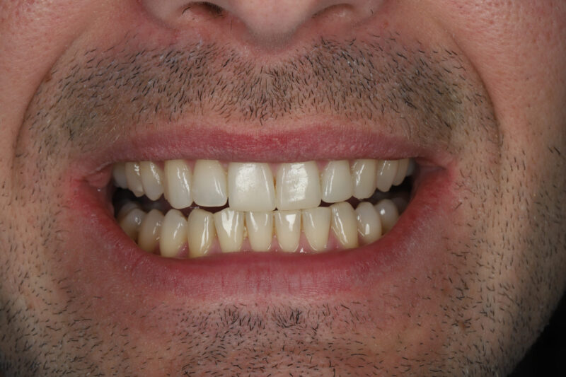 After - Cheadle Hulme Dental