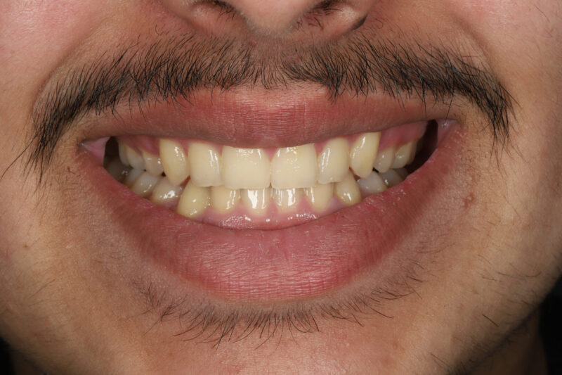 After - Cheadle Hulme Dental