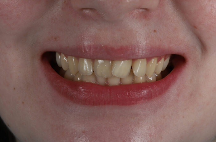 Before - Cheadle Hulme Dental