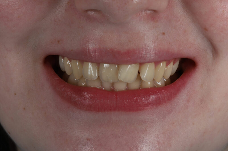 Before - Cheadle Hulme Dental