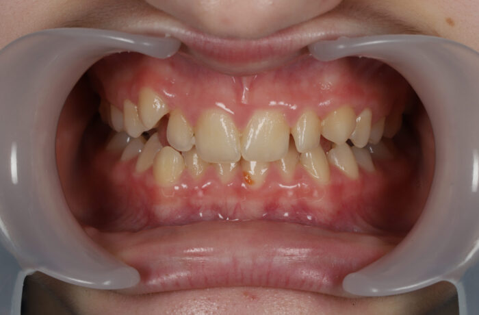Before - Cheadle Hulme Dental