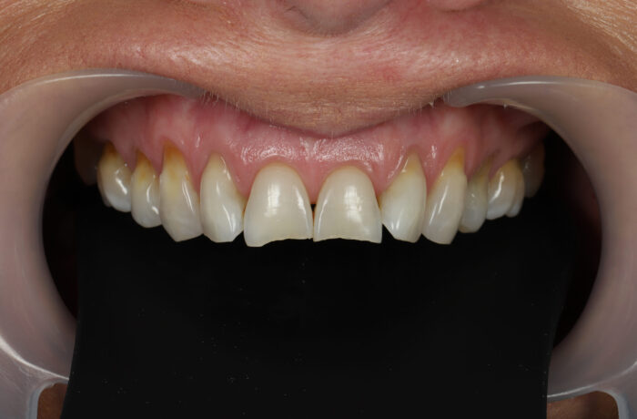 Before - Cheadle Hulme Dental
