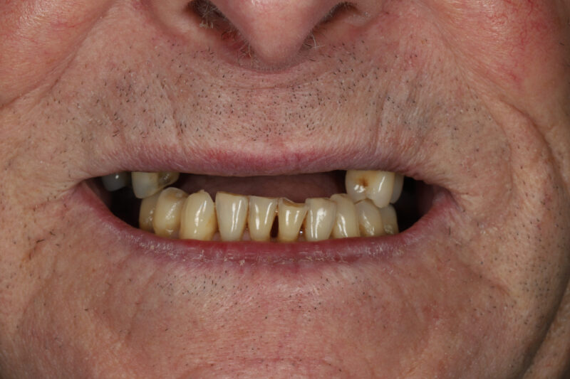 Before - Cheadle Hulme Dental
