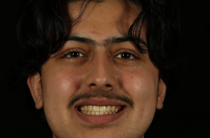 After - Cheadle Hulme Dental