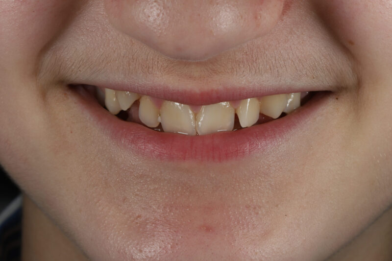 Before - Cheadle Hulme Dental