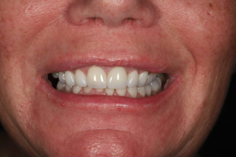 After - Cheadle Hulme Dental