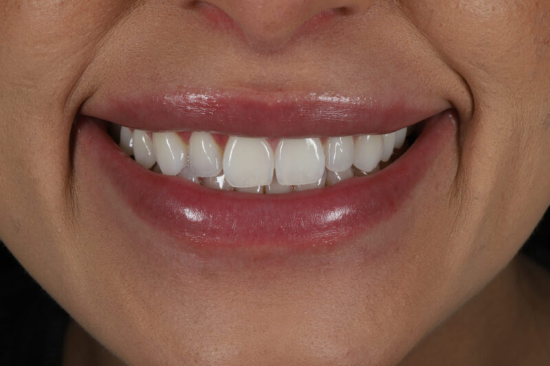 Before - Cheadle Hulme Dental
