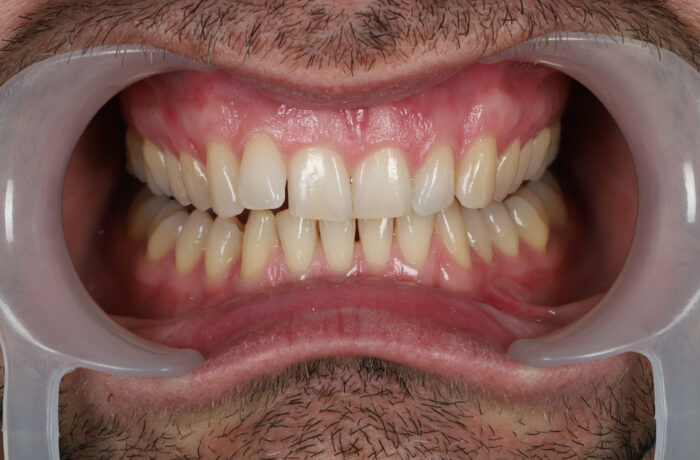 Before - Cheadle Hulme Dental