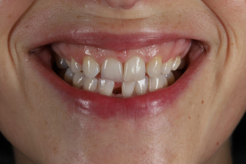 Before - Cheadle Hulme Dental