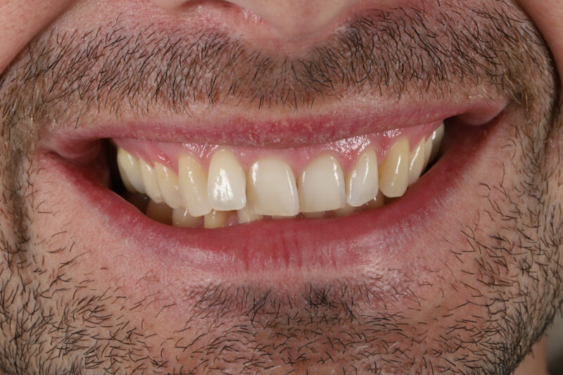 Before - Cheadle Hulme Dental