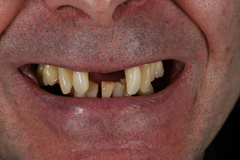 Before - Cheadle Hulme Dental