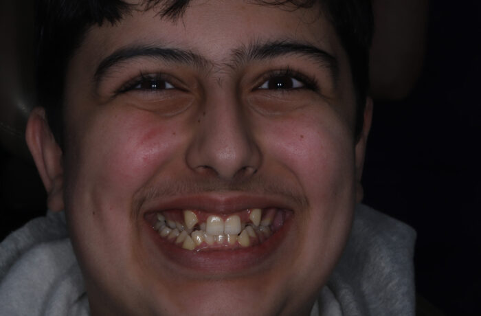 Before - Cheadle Hulme Dental
