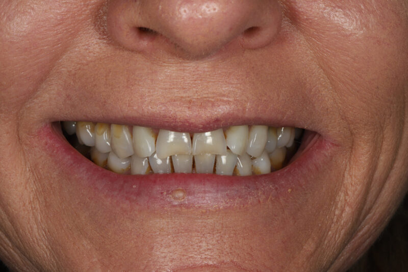 Before - Cheadle Hulme Dental