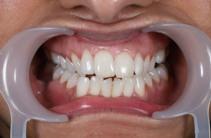 Before - Cheadle Hulme Dental