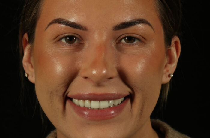 After - Cheadle Hulme Dental
