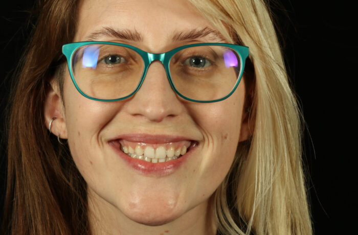 After - Cheadle Hulme Dental