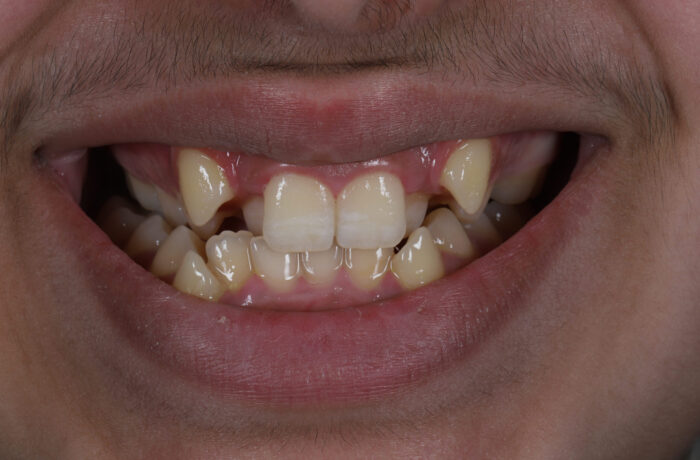 Before - Cheadle Hulme Dental