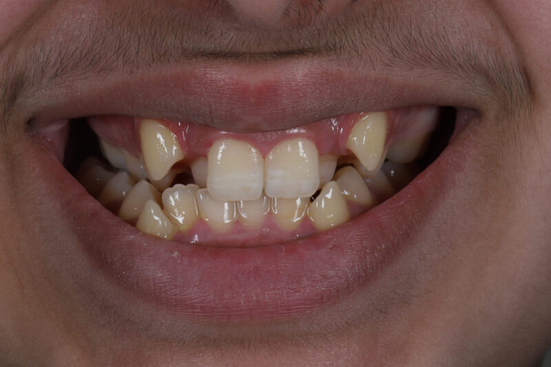 Before - Cheadle Hulme Dental