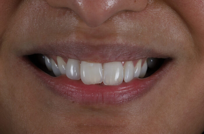 Before - Cheadle Hulme Dental