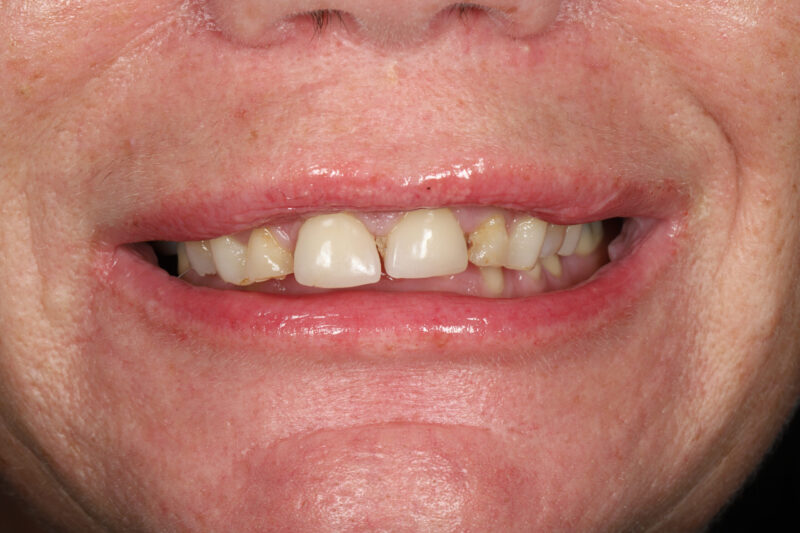 Before - Cheadle Hulme Dental