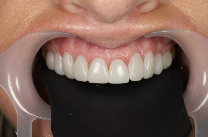 After - Cheadle Hulme Dental