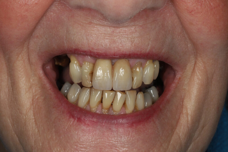 After - Cheadle Hulme Dental