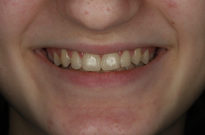 After - Cheadle Hulme Dental