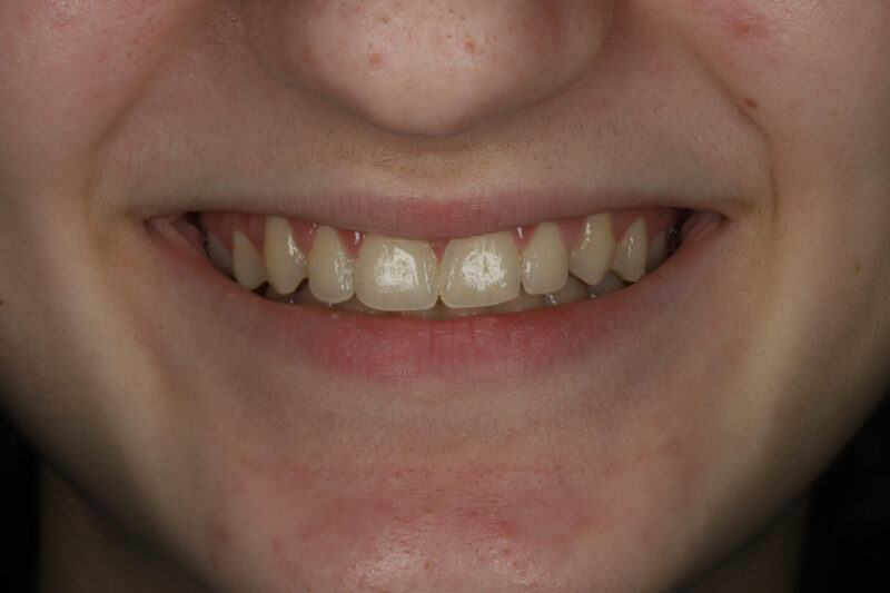 After - Cheadle Hulme Dental