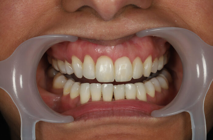 After - Cheadle Hulme Dental