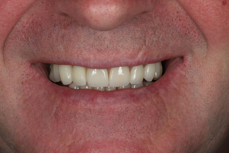After - Cheadle Hulme Dental