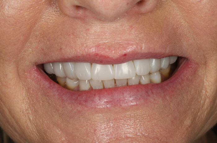 After - Cheadle Hulme Dental