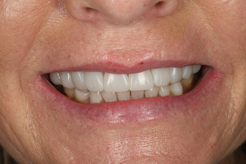 After - Cheadle Hulme Dental