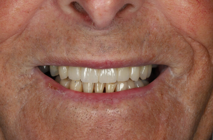 After - Cheadle Hulme Dental