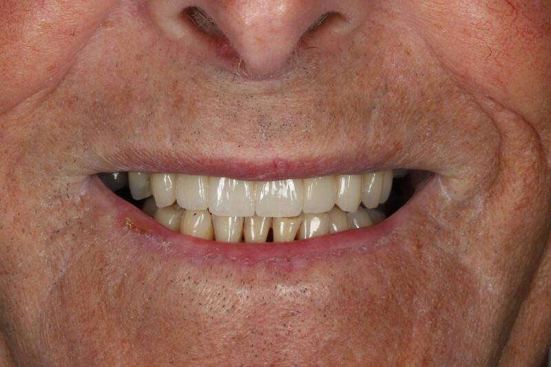 After - Cheadle Hulme Dental