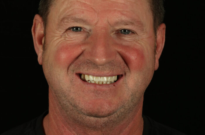 After - Cheadle Hulme Dental