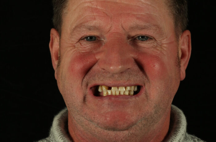 Before - Cheadle Hulme Dental