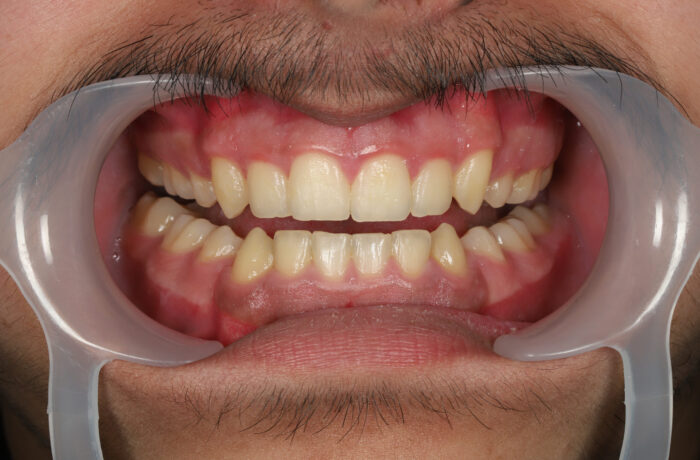 After - Cheadle Hulme Dental