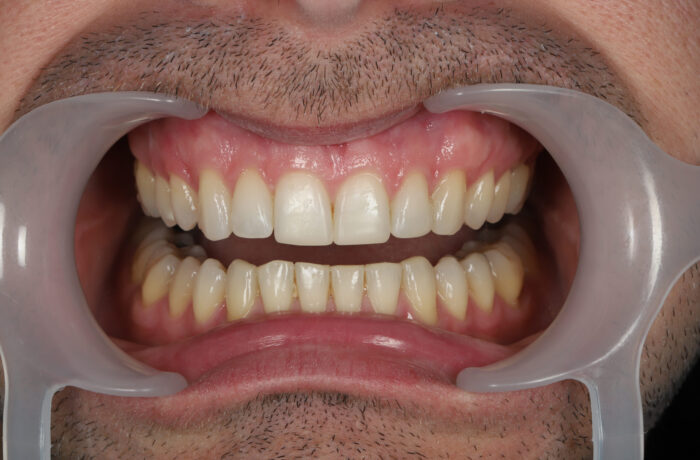 After - Cheadle Hulme Dental