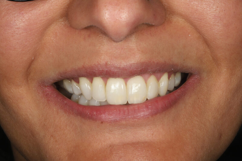 After - Cheadle Hulme Dental