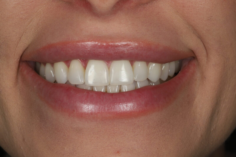 After - Cheadle Hulme Dental