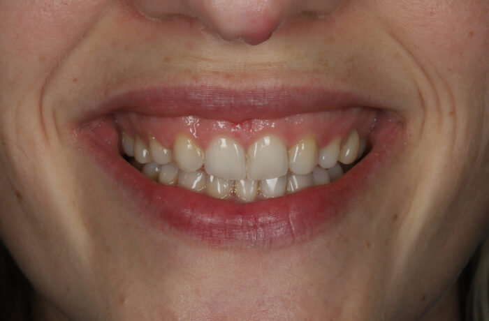 After - Cheadle Hulme Dental